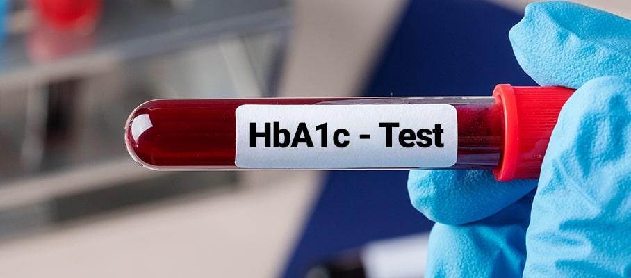 Hemoglobina Glicada (HbA1c): O que é e  porque é importante? - Duorum Saúde