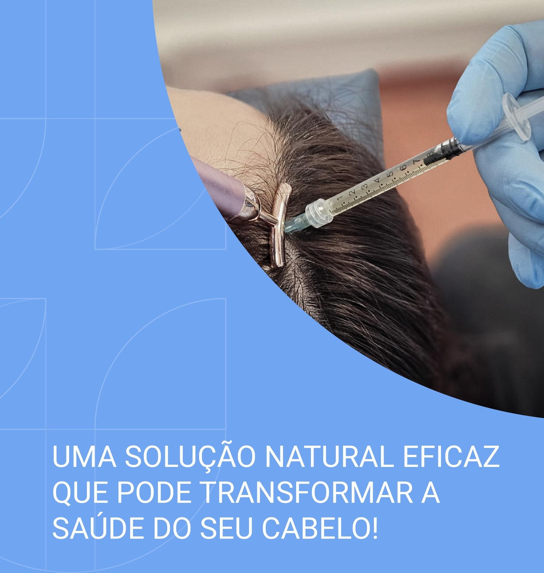 Plasma Rico em Plaquetas (PRP) - Duorum Saúde