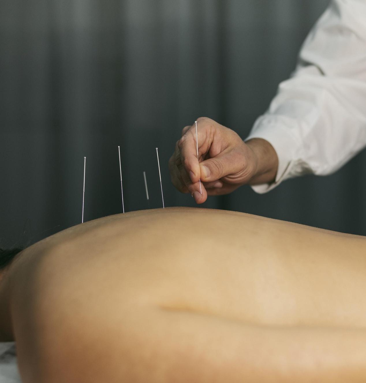 Medicina Tradicional Chinesa - Duorum Saúde